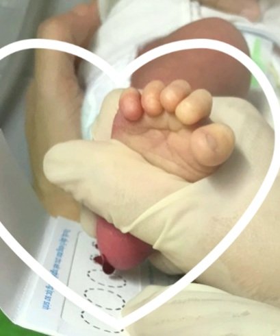 Trung tâm Y tế thành phố Yên Bái thực hiện sàng lọc sơ sinh cho bé